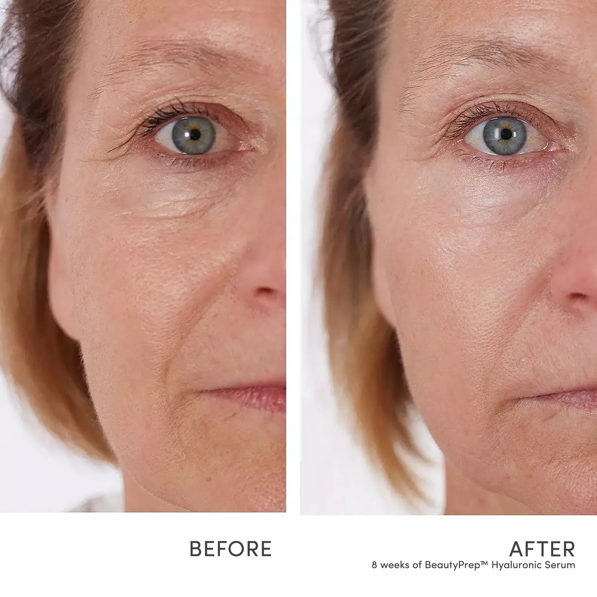 BeautyPrep™ Hyaluronic Serum Jane